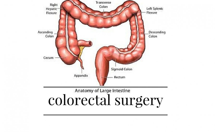 Useful information and tips about colorectal surgery